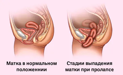 Как выглядят нормальные половые губы