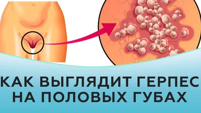 Пластика малых половых губ — лечение по выгодным ценам Доктор Титов Денис  Сергеевич