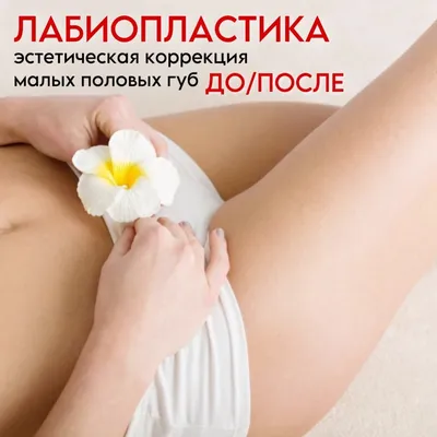 ▷Лабиопластика в Киеве – Интимна пластика половых губ ✓ Цены в МЦ ADONIS