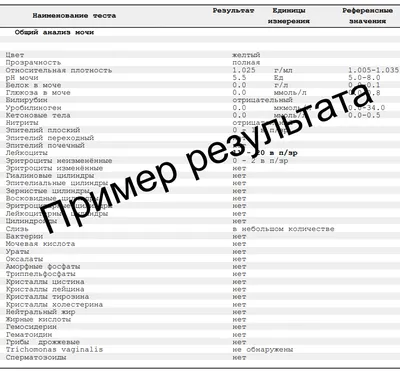 Фосфаты в моче у ребенка: причины, тактика действий. Случаи из практики -  фосфатурия у детей - YouTube