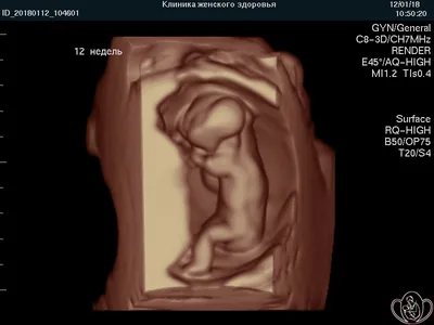 4D-УЗИ или первая видеозапись вашего малыша