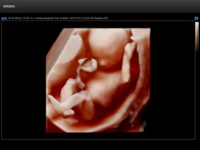 Скрининговое УЗИ при беременности | Блог о здоровье в клинике \"Скандинавия\"