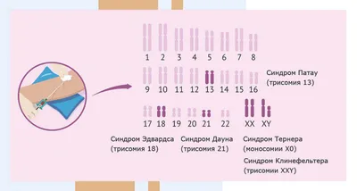 Жизнь до рождения - Новости - Сайт БУЗ ВО \"Верховажская ЦРБ\"