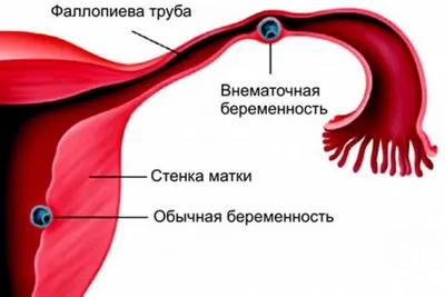 Некоторые особенности гормонального статуса в случаях с врожденной эктопией  шейки матки – тема научной статьи по клинической медицине читайте бесплатно  текст научно-исследовательской работы в электронной библиотеке КиберЛенинка