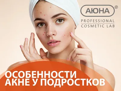 Лечение акне у подростков | Клиника АЛОДЕРМ , Москва