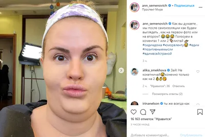 45-летняя Анна Семенович показала лицо без макияжа после косметолога -  Газета.Ru | Новости