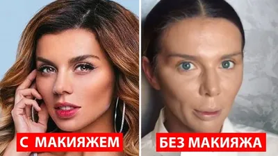 Как выглядят российские звёзды без макияжа