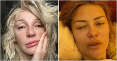 Как выглядят российские звезды без макияжа | ЗНАМЕНИТОСТИ | Дзен