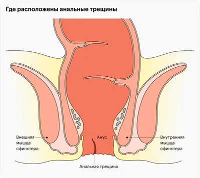 Пилка Для корневых каналов MTWO NiTi VDW Mtwo NiTi 25 мм 10-20 оригинальная  анатомическая модель корневых каналов Mtwo | AliExpress