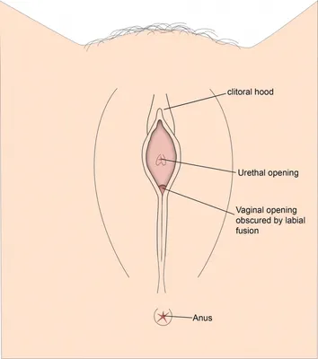 Atlas of visual inspection of the cervix with acetic acid for screening,  triage, and assessment for treatment