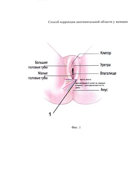 Коррекция (уменьшение больших половых губ) – цена в Москве