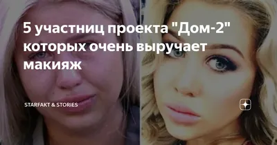 Пынзарь не была на дне рождения сына из-за пластического хирурга | WOMAN