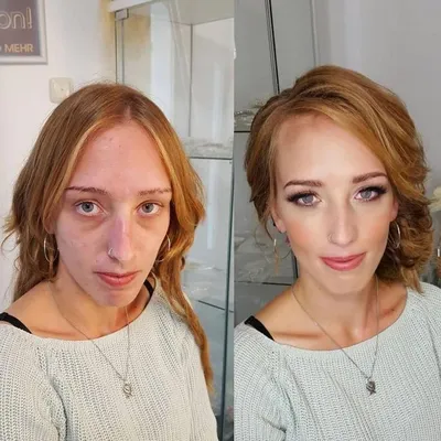 Девушка с ожогами лица изменила свою жизнь с помощью макияжа