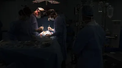 В Челябинске во время операции из сердца девушки достали живого паразита -  Газета.Ru | Новости