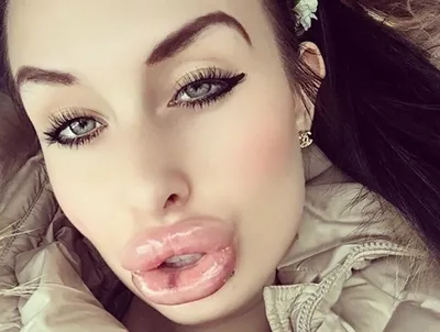 Девушка с самыми большими губами в мире рассказала о желании увеличить их  еще: Люди: Из жизни: Lenta.ru
