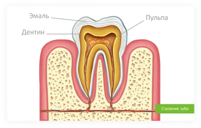 Гноится десна после удаления зуба — 4 причины, 5 симптомов и лечение |  Dental Art