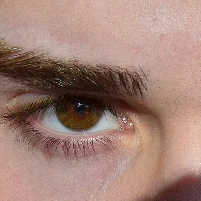 Желтые глаза: почему белки глаз у взрослого желтеют, что это значит и как  лечить