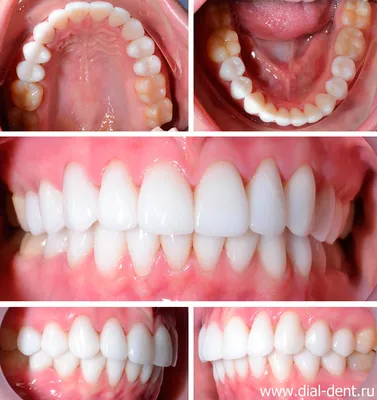 Голливудская улыбка как результат комплексного подхода
