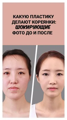 Какие пластические операции делают азиатки: шокирующие фото до и после |  Форма лица стрижка, Шикарная стрижка, Ринопластика