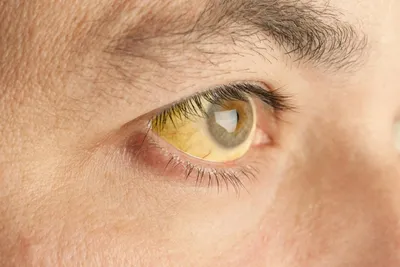 Цветные контактные линзы ADRIA Elegant - «Не перекрывают светлый цвет глаз  и смотрится не красиво» | отзывы