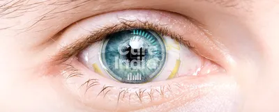 Лечение катаракты в Германии — Замена хрусталика глаза — Цены на операцию в  клинике Nordwest