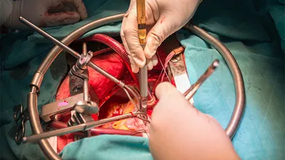 Тот, кто в тени хирурга: в Клинике Сердца Odrex работают анестезиологи  европейского уровня (новости компаний) | Новости Одессы