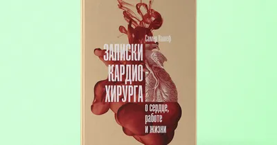 Восстановление после операции на открытом сердце | Опека пансионаты