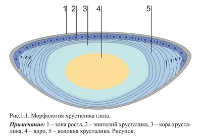 Факосклероз хрусталика глаза: причины, симптомы и эффективные методы  лечения заболевания - MOSCOWEYES.RU - сайт офтальмологического центра  \"МГК-Диагностик\"