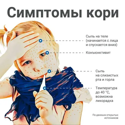 Краснуха у детей: симптомы, лечение, прививка, фото, полезная информация