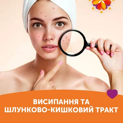 Лечение атопического дерматита (экземы), Киев