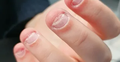 Детские анти-кусающие ногти не укусывают кусачки для ногтей лучший ребенок  нетоксичный унисекс не ест ногти | AliExpress
