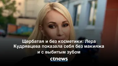 Фотошоп и грим мне в помощь»: почему Лера Кудрявцева не ходит к косметологу