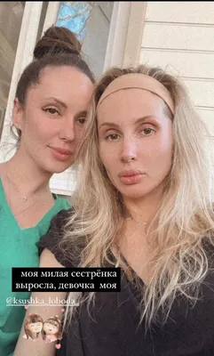 Светлана Лобода без макияжа и фотошопа: как выглядит - фото