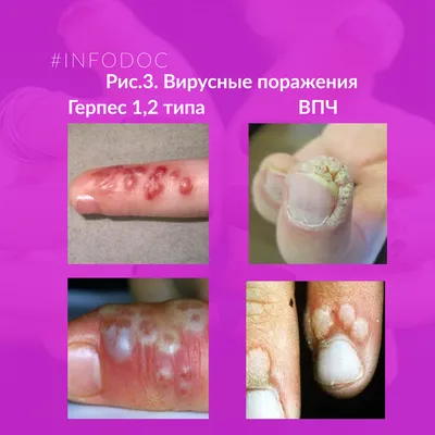 КУРСЫ МАНИКЮР ПЕДИКЮР НАРАЩИВАНИЕ ЕКАТЕРИНБУРГ (@nailcouture_ekb) •  Instagram photos and videos