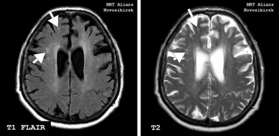 МРТ головного мозга 2500 ₽ запись в СПБ, скидка - 38% , центр \"Она\"