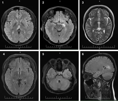 МРТ головного мозга с контрастом - сделать магнитно-резонансную томографию  головы с контрастированием