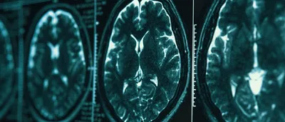 Норма КТ и МРТ изображений головного мозга и позвоночника. Атлас  изображений. 4-е издание - купить с доставкой по выгодным ценам в  интернет-магазине OZON (807546459)