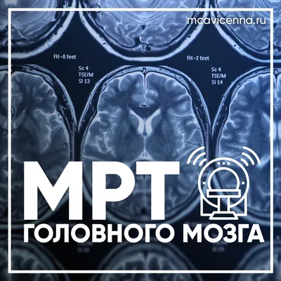 Расшифровка МРТ головного мозга: как читать результаты, норма и отклонения