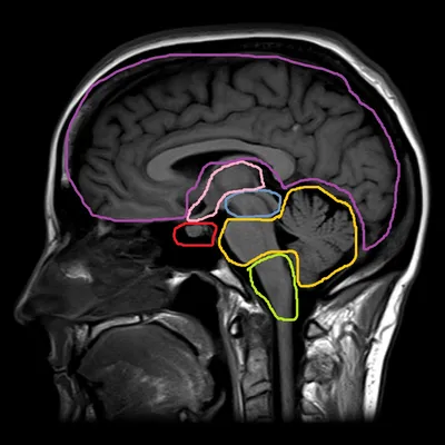 Головной мозг MPT 3D : нормальная анатомия | e-Anatomy