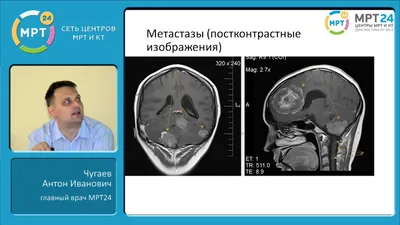 Сделать МРТ мозга и головы – Клиника-Сити Рязань