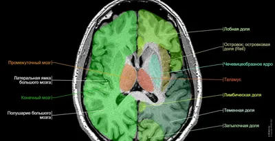 МРТ головного мозга для диагностики опухоли в Киеве • МРТ 3.0 Tesla