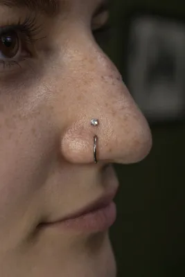 Утонченный нос: хирургическая ринопластика кончика носа
