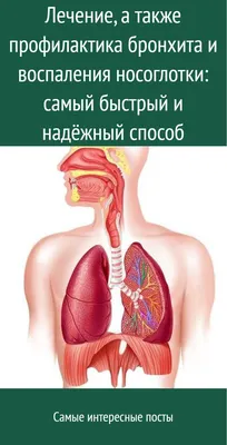 Киста Торнвальдта: причины, лечение, симптомы и диагностика заболевания