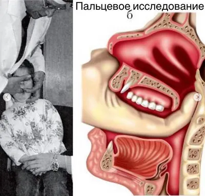 Эндоскопическое обследование ЛОР-органов в Одинлор