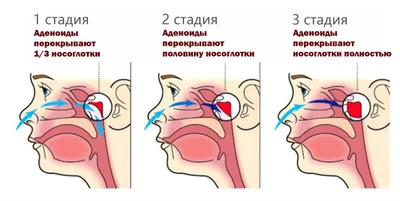 Морфологическая диагностика опухолей носа, околоносовых пазух и носоглотки,  А. А. Бахтин – скачать pdf на ЛитРес