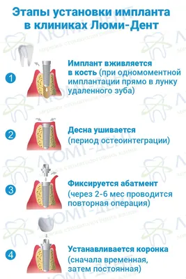 Воспаление вокруг импланта. Что покажет КТ? - Диагностический кабинет 3D KT+