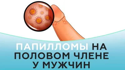 Что такое ВПЧ? Вирус папилломы человека | Врач дерматовенеролог, трихолог  Фоменко Лариса Викторовна