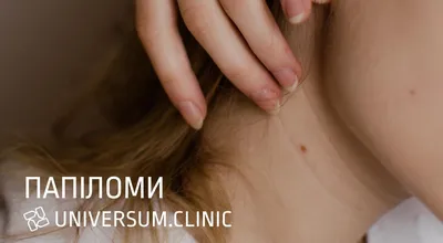 Удаление новообразований на коже - Beauty Clinic клиника врачебной  косметологии Тамбов