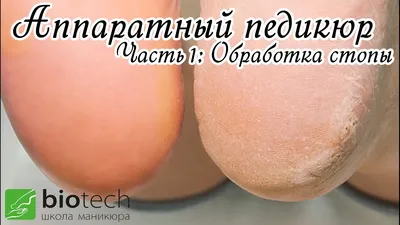 Педикюр в Камчатском крае - Педикюр - Красота: 79 мастеров ногтевого  сервиса со средним рейтингом 5.0 с отзывами и ценами на Яндекс Услугах