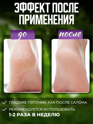 Getox Увлажняющий крем для гладких пяток и стоп ног с мочевиной